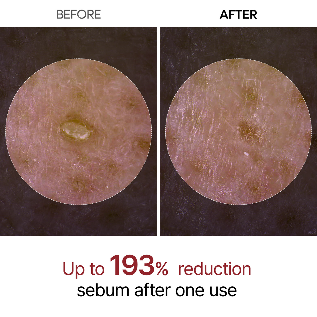Peel Shot Glow Rice Ampoule Duo & Kojic Acid Duo